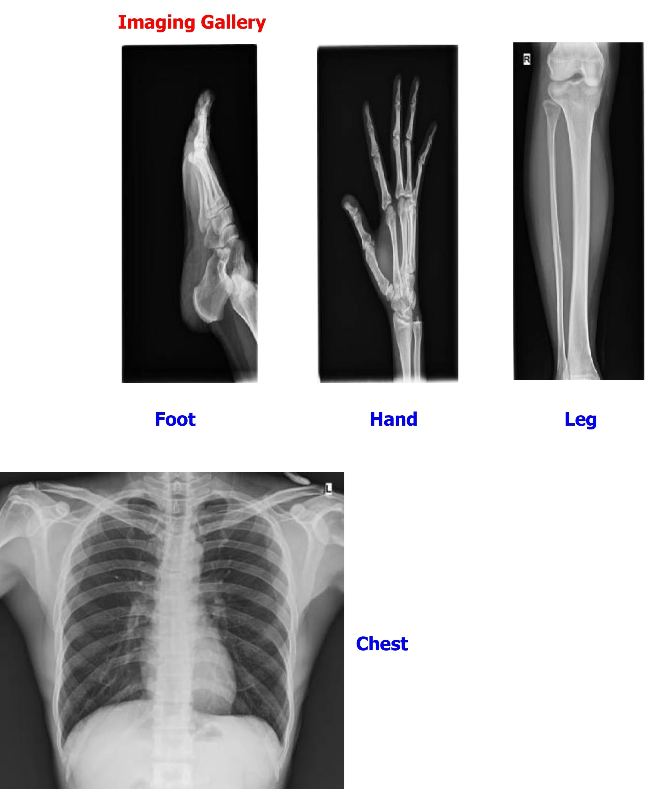 Équipement de radiographie mob - Xlab Medical avis et prix