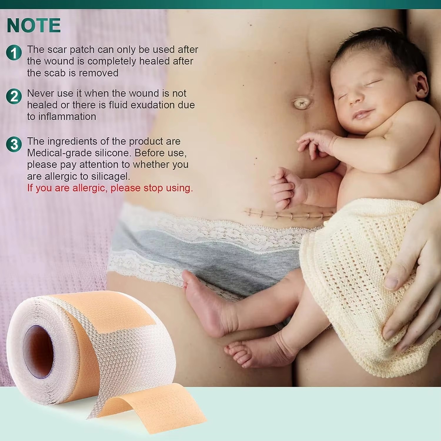 Feuille de cicatrice en Gel de - Medical Tape avis et prix