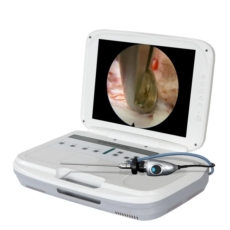 Système d'endoscopie portable  - Medical Lab Images avis et prix