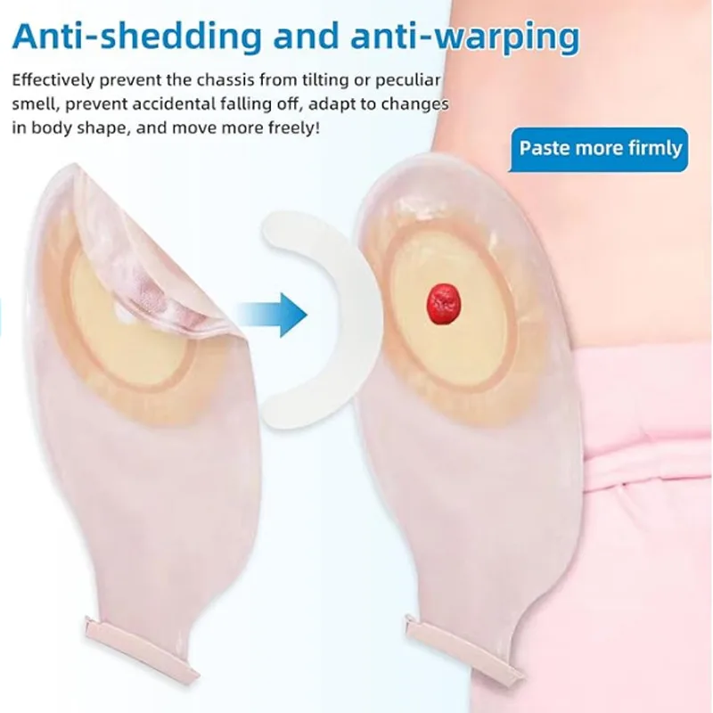 Bande de renforcement pour poc - Medical Tape avis et prix